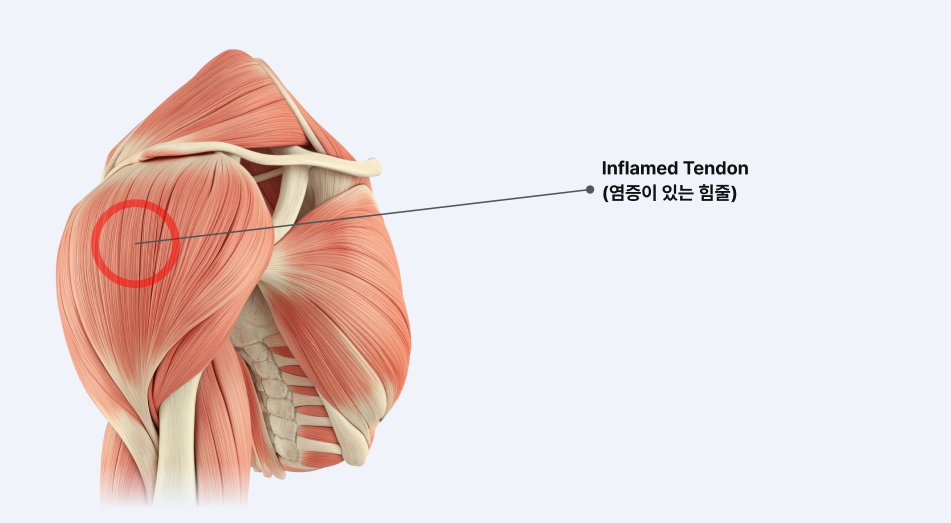 디스크 단면 일러스트