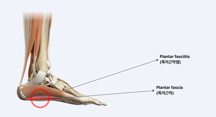 디스크 단면 일러스트